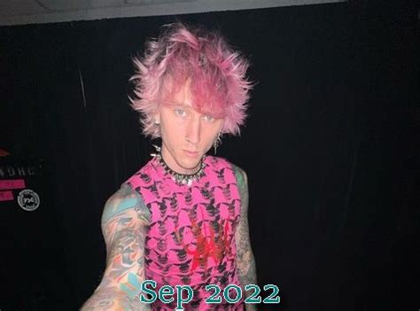 MGK Hair Transplant and How He Looks Now