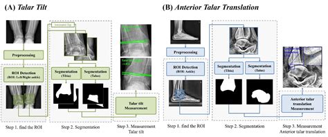 GitHub - seungha164/Automated-radiography-assessment-of-ankle-joint