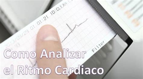 Análisis Del Ritmo Cardíaco Cerebromedico