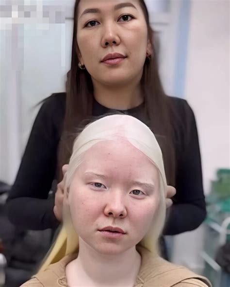This Albino Girl Unveiled A Gorgeous Brunette Transformation That Left Everyone In Awe
