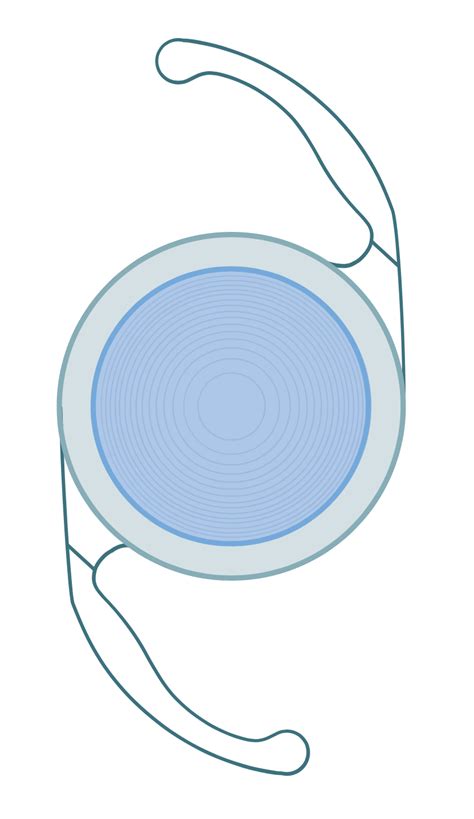 Multifocal IOL - Dr Rehman Siddiqui