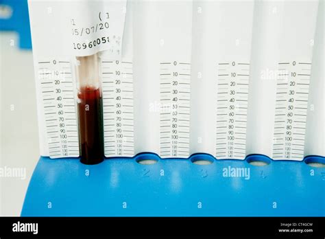 ERYTHROCYTE SEDIMENTATION RATE Stock Photo - Alamy