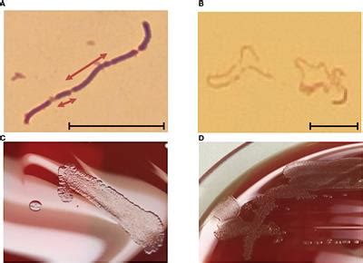 Frontiers Human Erysipelothrix Rhusiopathiae Infection Via Bath Water