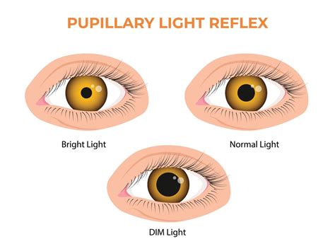Pupillary light reflex PLR or photopupillary reflex 22720646 Vector Art ...