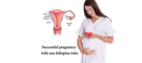 Successful Pregnancy With One Fallopian Tube Fertility Treatment