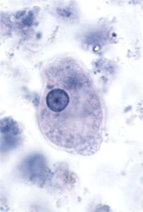 Entamoeba Histolytica Trophozoite