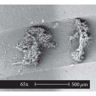 Scanning electron microscopy images of the tip and cuff of the central ... 