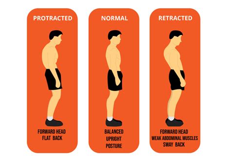 Why Posture Matters Understanding The Importance Of Correct Posture