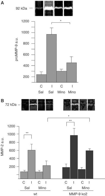 Zymography analysis of MMP-9 (A) and MMP-2 (B). Zymography analysis of... | Download Scientific ...