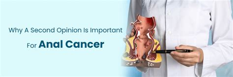 Importancia de una segunda opinión en el cáncer anal