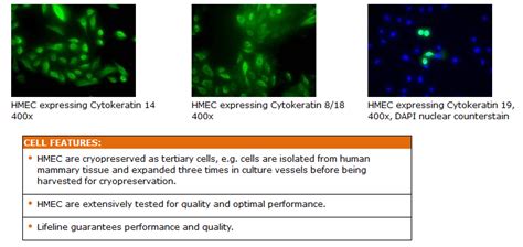 Primary Human Male Mammary Epithelial Cells