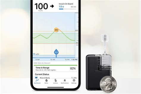 The Smallest Artificial Pancreas System Receives Fda Clearance