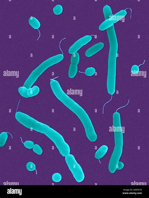 Coloured Scanning Electron Micrograph SEM Of Vibrio Parahaemolyticus