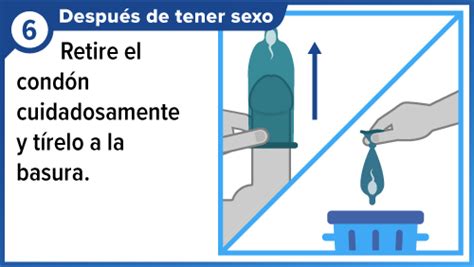 Cómo usar un condón | Condom Use | CDC