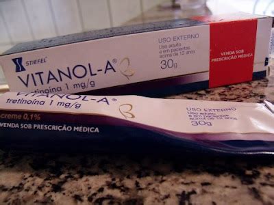 Estrias to fora : Dermaroller com Vitanol A 1 % (acido retinoico )