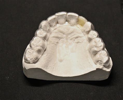 Smith Dental Laboratory LLC | West Jefferson OH