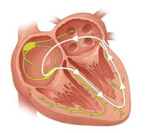 WPW феномен: причины, симптомы, диагностика и лечение