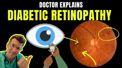 Doctor Explains Diabetic Retinopathy Eye Disease Stages Symptoms