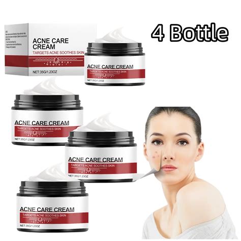 Acne Cream, Powerful Face Care Cream Dry Face Care Instantly Moisturize