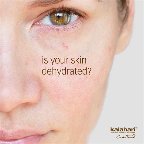 How to tell that your skin is dehydrated... your skin stings or itches