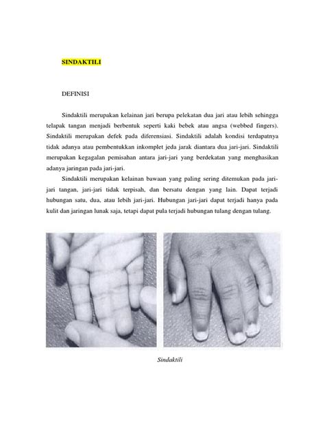 Sindaktili Pengertian Penyebab Dan Penanganannya