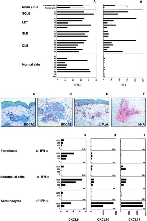 Ultraviolet Radiationinduced Injury Chemokines And Leukocyte