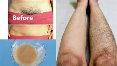How To Remove Bikini Pubic Hairs Facial Hairs Painlessly At Home YouTube