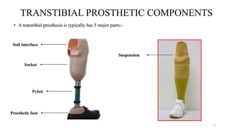 PROSTHETIC MANAGEMENT OF TRANSTIBIAL AMPUTATION AND ITS BIOMECHANICS ...