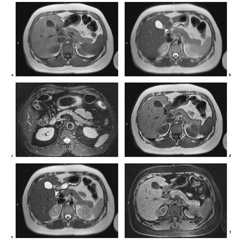 The Pancreas Radiology Key