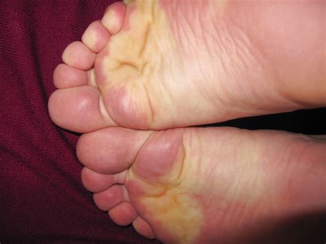 Soles Porn Pictures XXX Photos Sex Images PICTOA