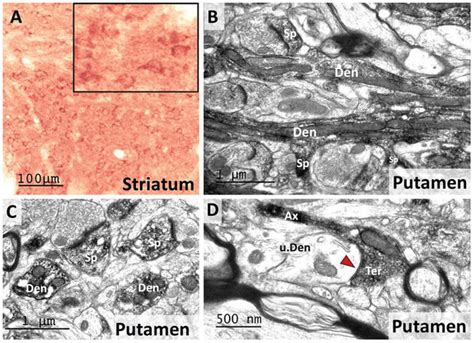 Rgs14 Is Localized In Dendrites And Spines Of Gabaergic Projection