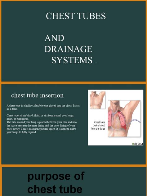 Chest Tubes | PDF