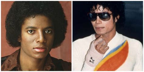 Did Michael Jackson Have A Skin Disease - vrogue.co