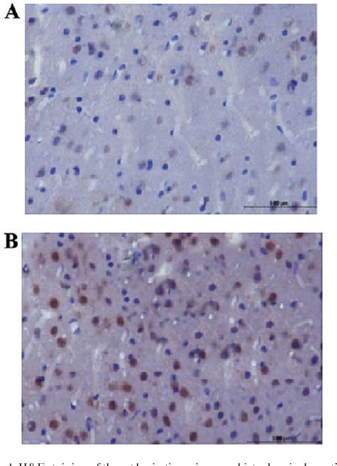 Figure From Effects Of Hucb Mscs On Recovery Of Neurological Function