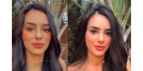 Foto Bruna Biancardi Antes E Depois Da Rinoplastia Purepeople