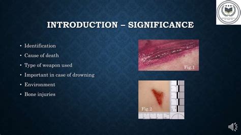 Antemortem And Postmortem Woundspptx