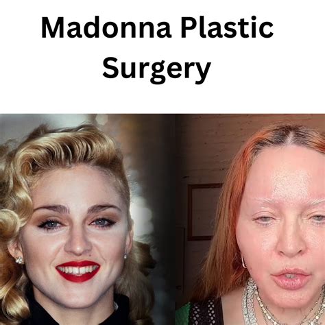 Madonna Plastic Surgery Transformation: An Icons Quest for Eternal