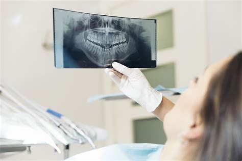 Everything You Need To Know About Dental X Rays From 123Dentist