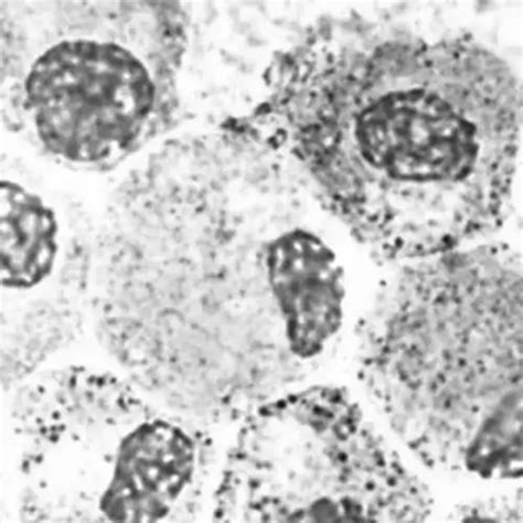 human mast cells kosheeka