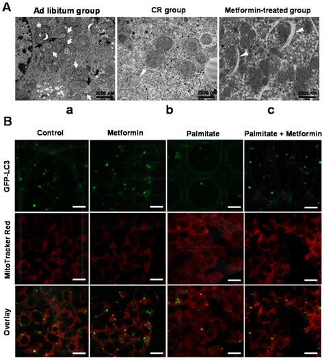 IJMS | January 2016 - Browse Articles 