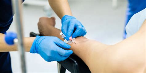 Educating Patients with Chronic Kidney Disease Can Reduce Mortality Risk