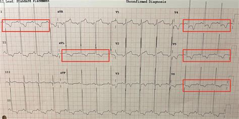 pain  strain kwak talk