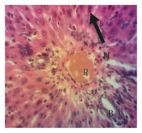 Photomicrographs Of Liver Tissue Sections Of The Experimental Groups