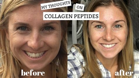 My Thoughts On Collagen Peptides Benefits Plus My Before And After