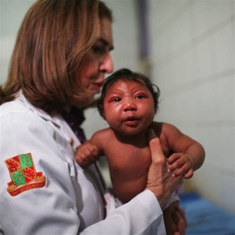 What You Should Know About The Birth Defect Tied To Zika