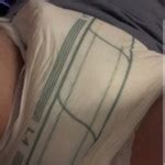 Upset Tummy Pornhub Gay