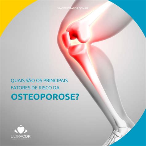 Quais são os principais fatores da osteoporose Ultracor