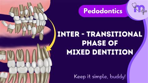 inter transitional phase  mixed dentition pedodontics animated