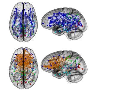 Sex Differences In Connectome Image Eurekalert Science News Releases