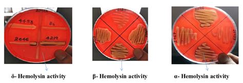 Hemolytic Activities Of S Aureus On Sheep Blood Agar Plate A